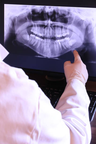 Best Emergency Wisdom Teeth Removal in Mclean, TX