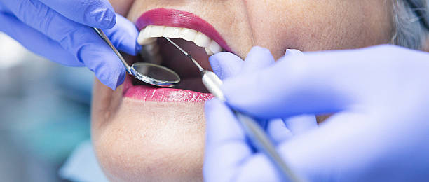 Best Emergency Treatment for Dental Infections or Abscesses in Mclean, TX